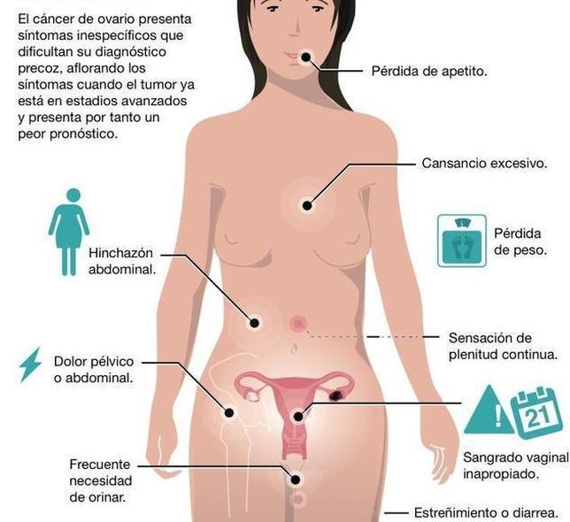 sintomas del tumor abdominal sintomas del tumor abdominal